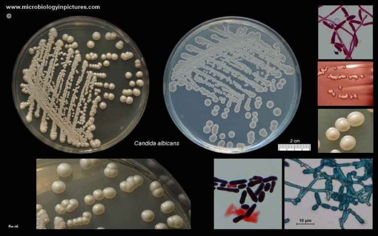 Candida albicans